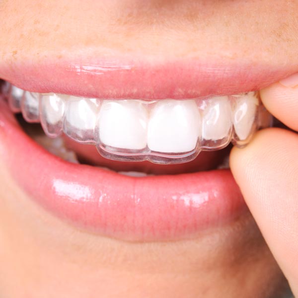 Braces & Orthodontics, Family Dentist & Orthodontist